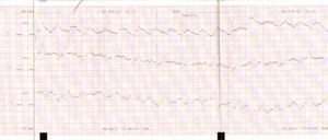 Electrocardiograma de un perro