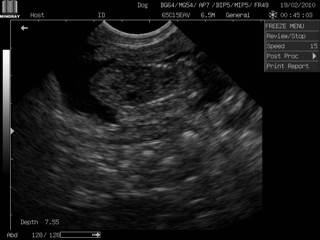 Imagen de un feto de 6 semanas
