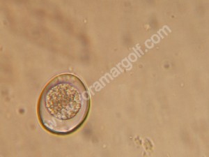 Imagen microscópica de un coccidio. 