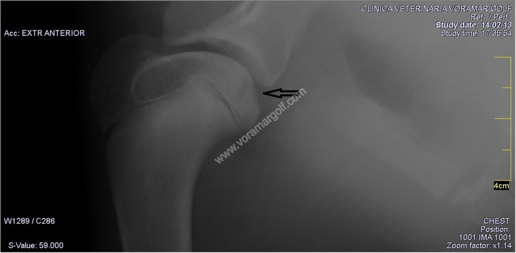 Osteocondritis disecante de hombro en un cachorro. 