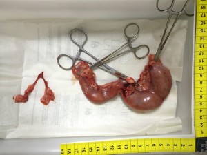 A la izquierda el utero de una perra de 8 meses y 5 kg de peso,  esterilizada antes del primer celo. A la derecha el utero de una Yorkshire Terrier de  3 kg de peso, con piometra.