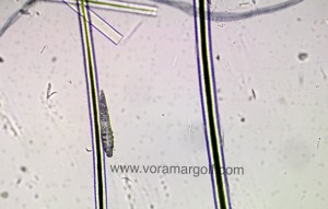 Demodex visto con tricograma. 