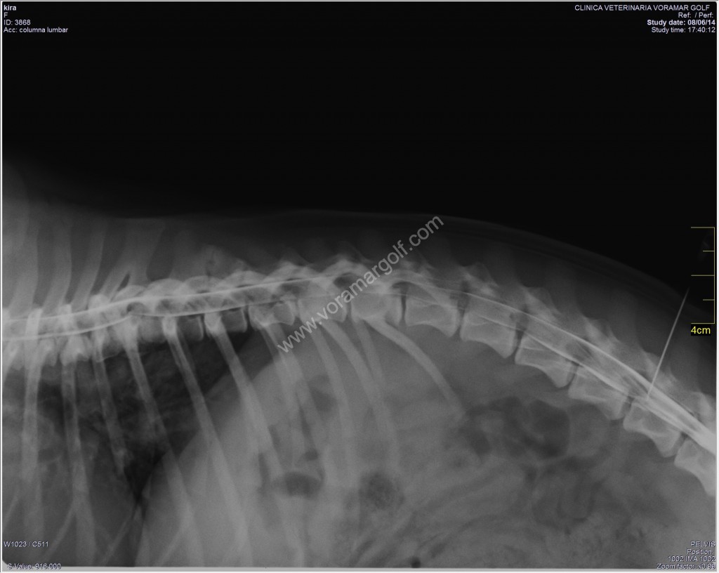 En el caso de Kira realizamos una mielografia para localizar la hernia y operarla de urgencia.