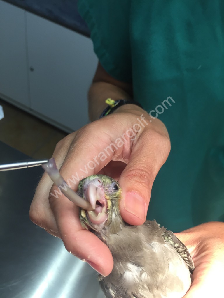 Momento final de la extracción del tubo que se había tragado. 