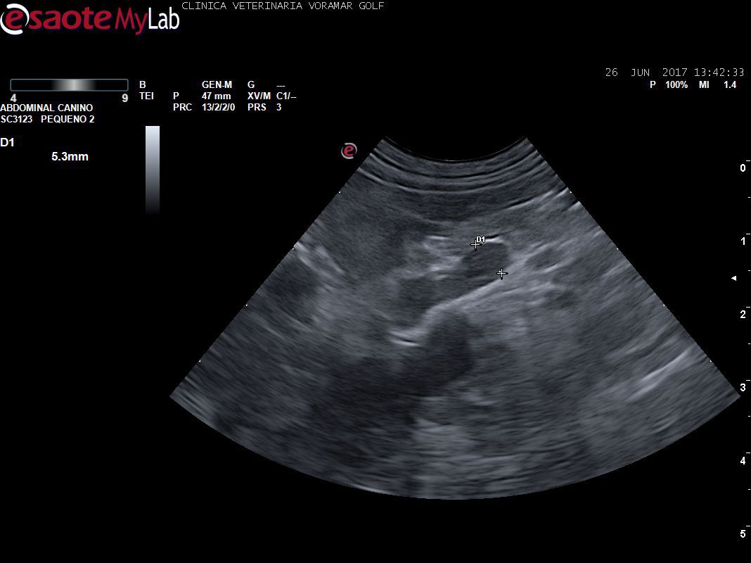 Estudio de Glandula adrenal. Nuestro ecógrafo nos permite ver la corteza y la medula adrenal, importante para el diagnostico de hiperplasias o tumores de esta glándula