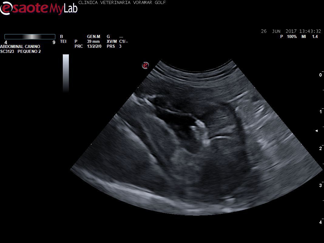 Estudio del estomago. Nuestro ecógrafo nos permite ver las capas del estomago, ver posibles masas, ulceras, gastritis, o cualquier tipo de patología