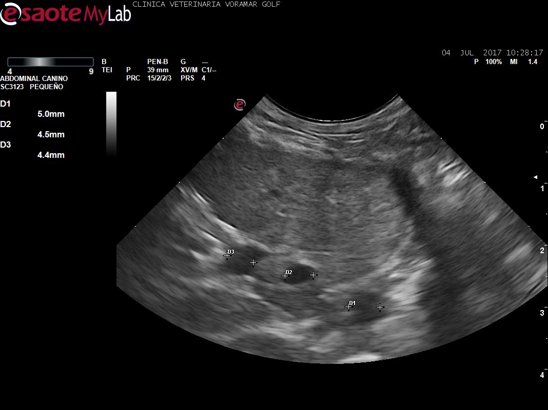 Estudio vascular de la vena cava, de la aorta y de la porta. Este estudio es fundamental para detectar hipertensión portal en patologías del hígado, o cardiacas, para ver shunts porto-cava