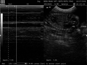 Feto de 8 semanas y estudio de su ritmo cardiaco.